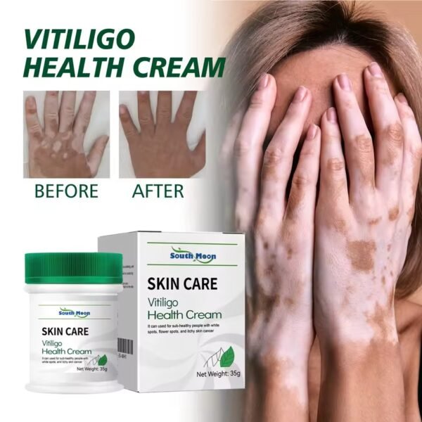 VitiligoCare